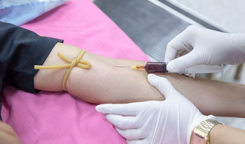 Testosteronspiegel messen – Zuverlässige Methoden + Tipps